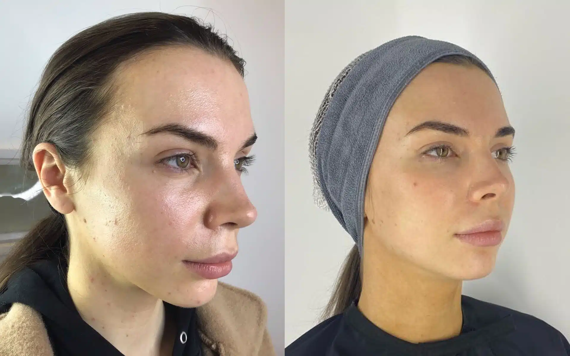 Skin-Concerns-Oily-Skin
